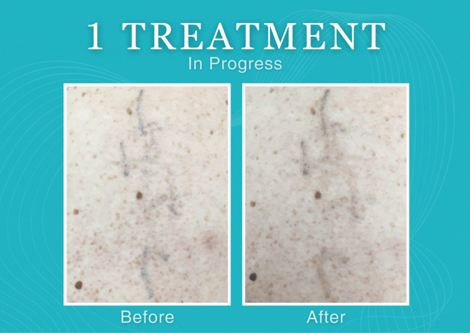 1363 MichaelPeier1.gif