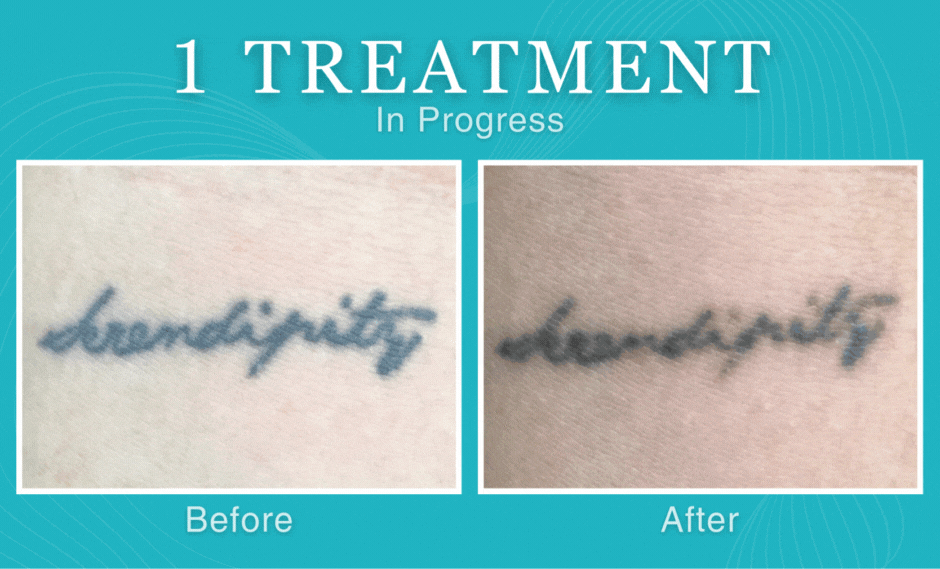 1236 SnowyBorghin1.gif