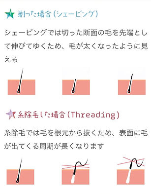 蝶式糸除毛2.jpeg