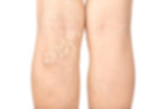 iStock-636765982.jpg