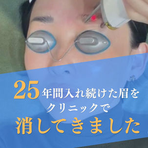 25年入れ続けた眉を、クリニックで消してきました