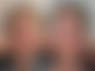 Injetáveis ou tecnologias: qual a melhor opção para estímulo de colágeno e tratamento de flacidez?