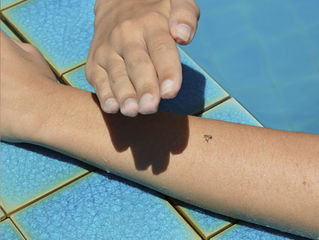 VIRUS ZIKA: ¡PRECAUCIONES QUE DEBES DE TOMAR!