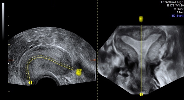 Echographie gynécologique et obstétricale | Le Chesnay | CEDEF