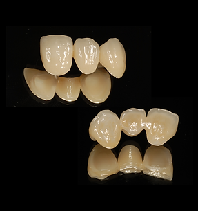 Layered Zirconia