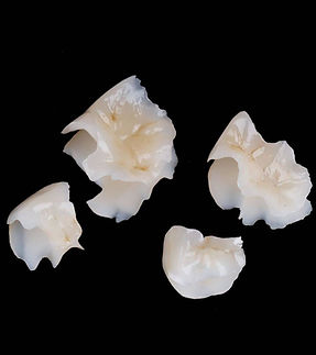 プレスセラミック