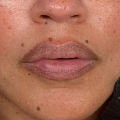 Lip Neutralization before and after by Palette by Hannah.