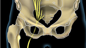 The Biggest Myths About Sciatica (and What Actually Helps)