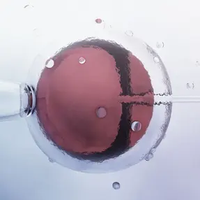 Does Intracytoplasmic Sperm Injection (ICSI) Boost IVF Odds?