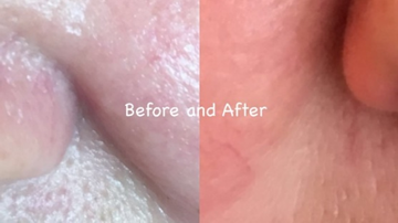 Thumbnail: Celebrity Stem Cell Serum