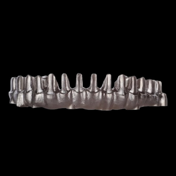 Implant restoration-Screw retained Restoration.png