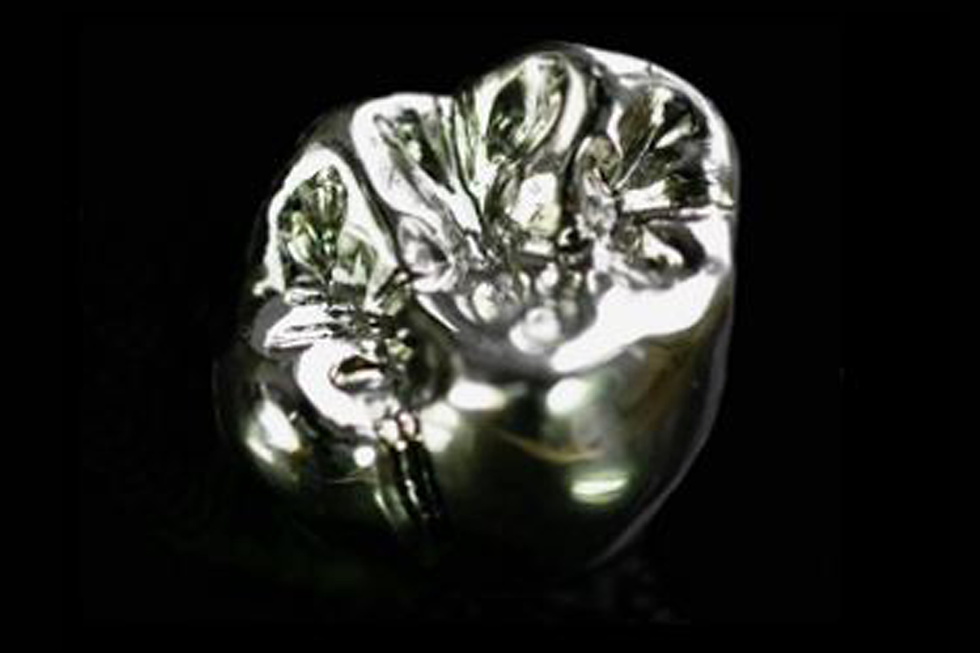 crown and bridges.png