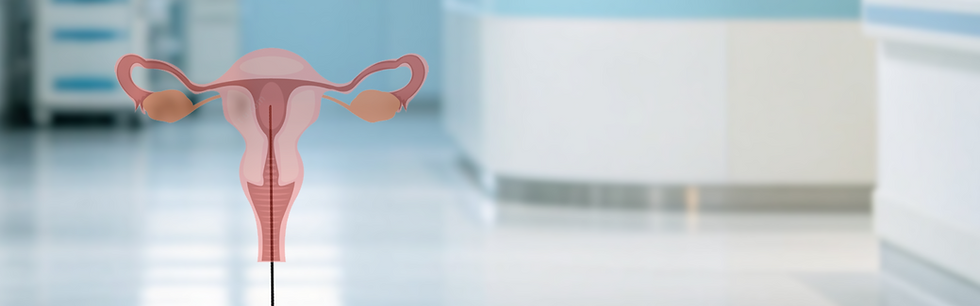 hysteroscope-头图.png