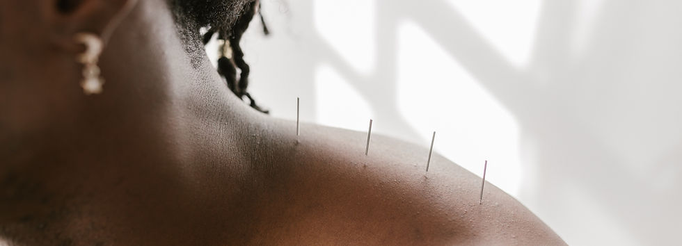 How does acupuncture for pain relief work?