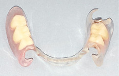 denture_img_03.jpg