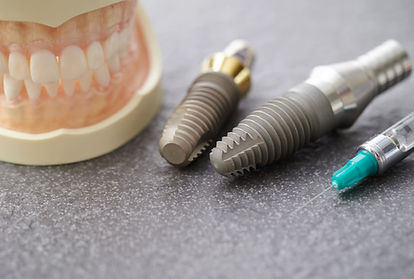 implant.jpg