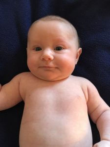 Zoe's MCADD Diagnosis