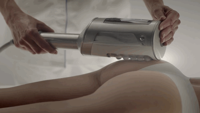 endo gif.gif