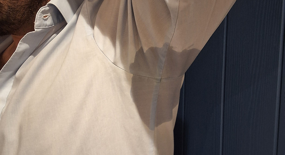 Hyperhidrosis excessive perspitation
