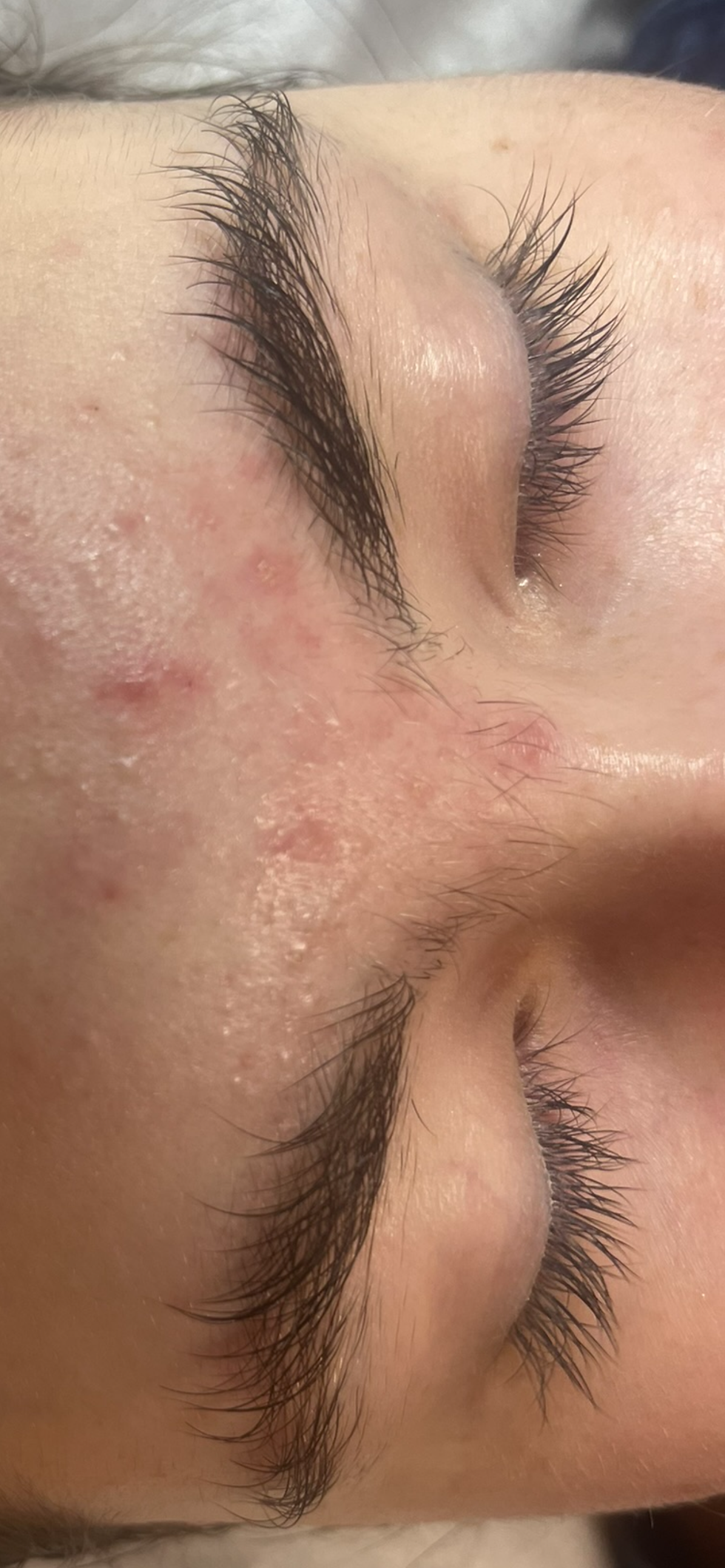 Eyebrow Before