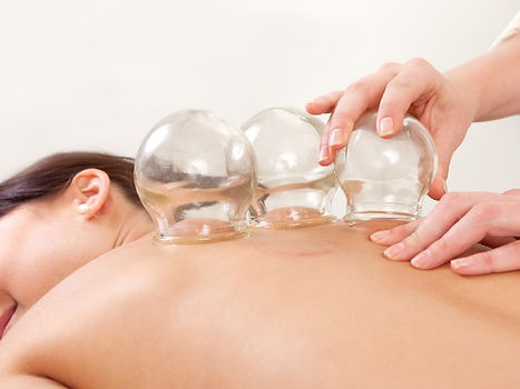 Cupping Therapy (5).jpg