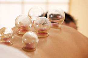 cupping-therapy-alternative-medicine.jpeg