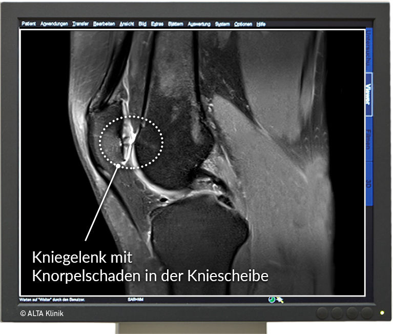 Close-up view of orthopaedic surgeon examining knee MRI scan