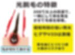 光脱毛の特徴