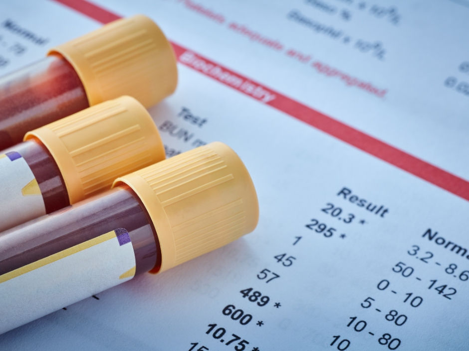 Conventional Blood work
