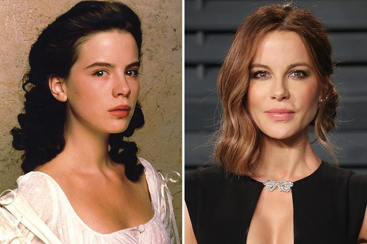 Kate Beckinsale Plastic Surgery Before After