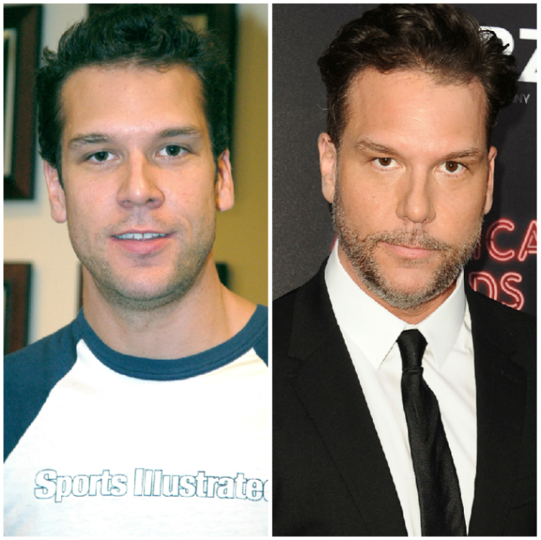 Dane Cook Plastic Surgery