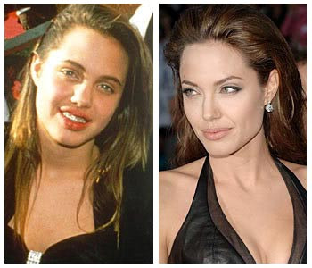 Angelina jolie before after