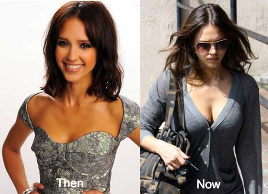 Jessica Alba Breast Surgery