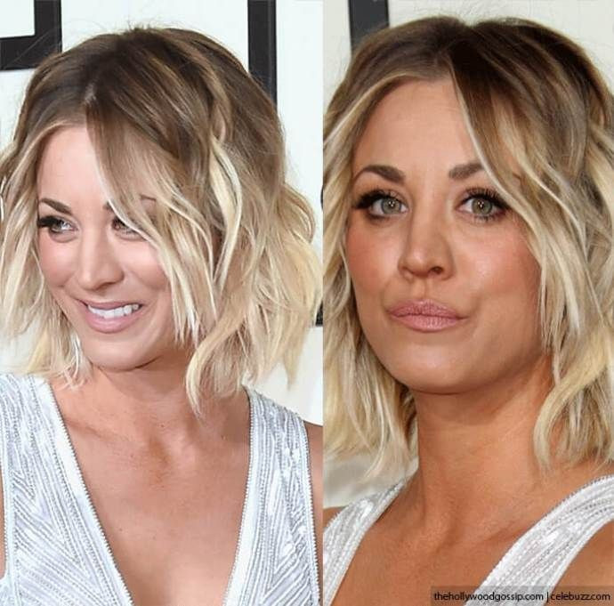 Kaley Cucuo Rhinoplasty