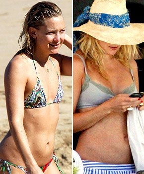 Kate Hudson Breast Surgery Before After