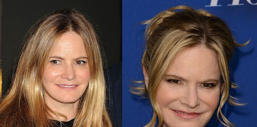 Jennifer Jason Leigh Plastic Surgery Before After