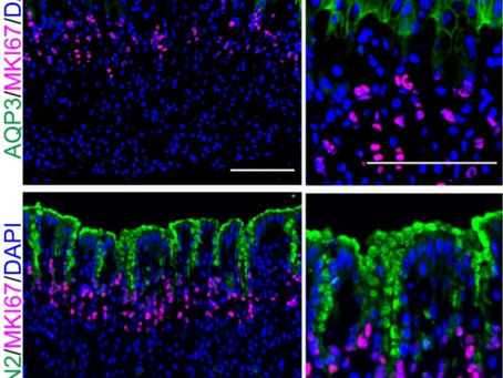 胃粘膜を保護する幹細胞分化制御のしくみを解明