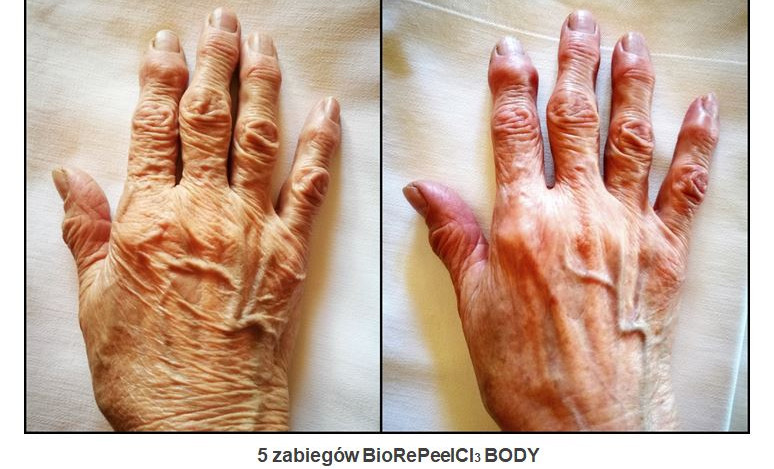 BODY_3.JPG