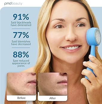 brosse visage anti acné