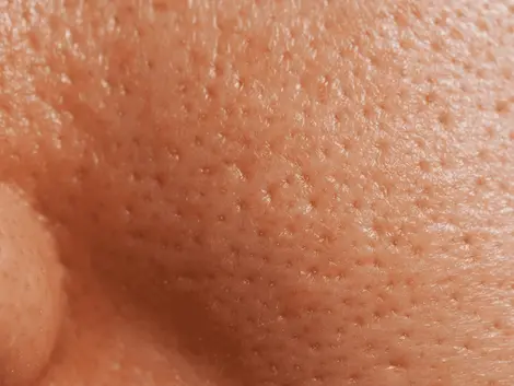 Pores de peau