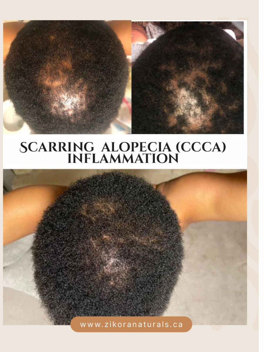 Thumbnail: Botanical Scalp Oil (Scalp Vitality)