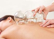 Cupping Therapy (5).jpg