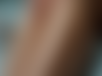 Síntomas de problemas venosos que no debes ignorar