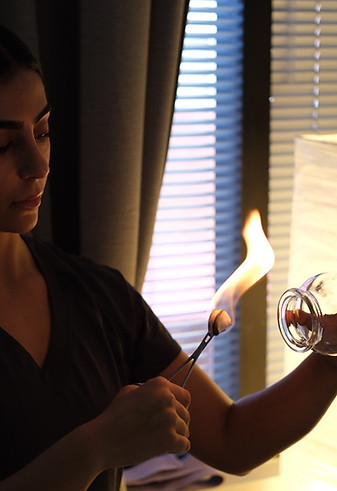 Fire Cupping