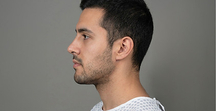 despues-cirugia-maxilofacial-allura.jpg