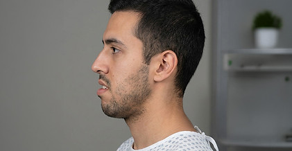 antes-cirugia-maxilofacial-allura.jpg