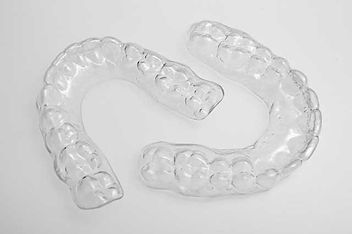 clear-retainers.jpg
