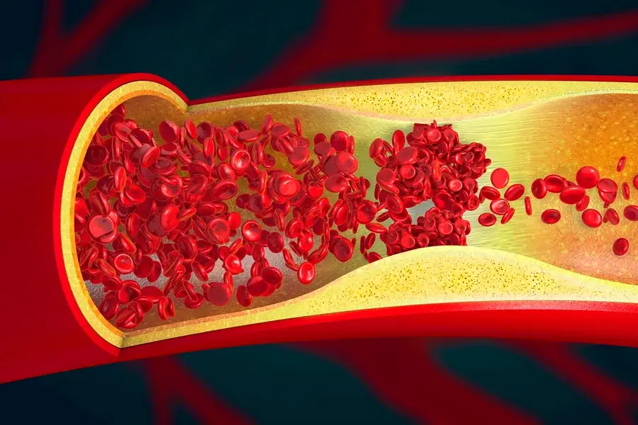 Imagem ilustrativa do interior de uma artéria