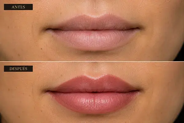 antes y despues de micropigmentacion de labios en Barcelona Mirik Beauty