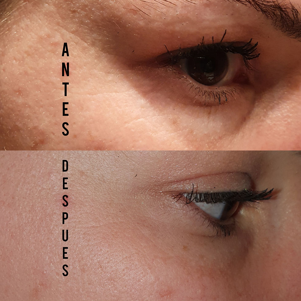 Thumbnail: Collagen eye mask 30 pairs